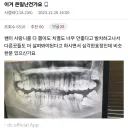 사랑니 갤러리
