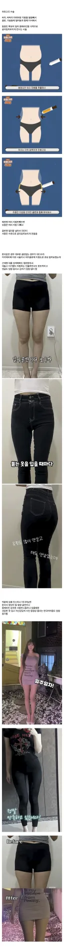 요즘 여자들한테 인기많다는 몸매 성형수술.jpg