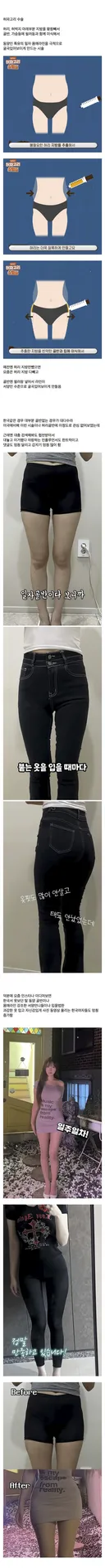 요즘 인기 많다는 성형수술