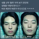 넷플 신작드라마 '들쥐'에서 논란이 된 성형 장면.jpg