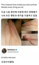 몸에 기생하는 거대한 생명체.jpg