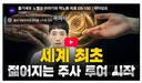 실제 역노화 주사 치료 임상실험 돌입 했다는데