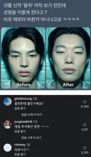 현재 넷플 신작 드라마 '들쥐'에서 논란이된 성형 장면 ㄷㄷㄷ;;