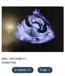 개붕이 2년 지났는데 큰일난거 같다....