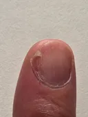 손톱 스트레스네요