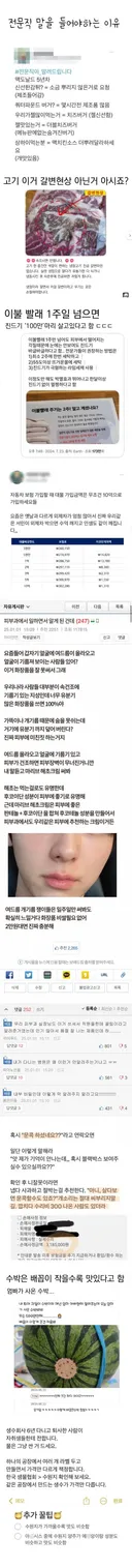 전문직 말을 들어야 하는 이유