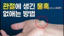 의외로 단순하지만 깔끔했던 고대 치료 방법