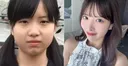 중1부터 성형 시작한 日 걸그룹 멤버... 수술비만 5500만원 고백