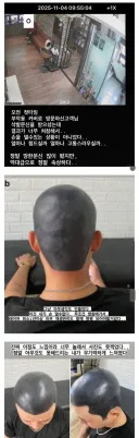 타투샵 사장이 병원 가라고 한 문신