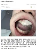 프링글스 뚜껑으로 장난치다 ㅈ된 아저씨.jpg