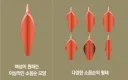 소음순 정리