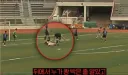 작년 동호회 축구 중 후두부 가격사건 근황