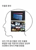우울증 환자의 머리속