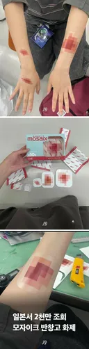 일본서 2천만 조회 모자이크 반창고