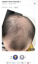 펌) 35살인데 약 먹으면 가능성 있음?...jpg