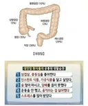 대장암 환자들 공통된 생활습관