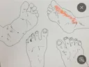 러닝 할때 신발 왼쪽은 멀쩡한데 오른쪽발이 쓰려요