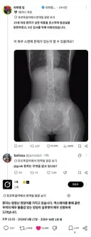 AI 영상의학과 거의 대체 가능..