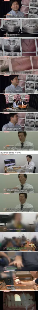 한때 유명했던 사이코패스 치과의사 사건+후기