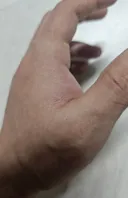 와 손에 통증이 싹 사라짐
