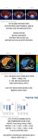 마운자로 1년 맞았더니 내장지방에 생긴 변화.jpg