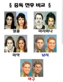 중독이 일으키는 얼굴 변화