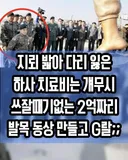 2억짜리  발목 동상
