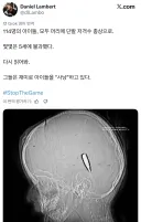 진짜 정신나갈것 같은 이스라엘 근황