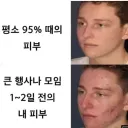 약속날 피부상태 공감
