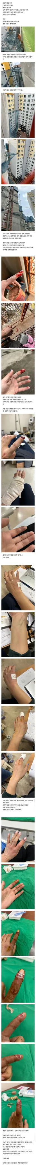 약혐) 길고양이한테 물리면 안되는 이유 ㄷㄷ