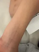 주짓수 체육관에서 폭행을 당했는데 어떻게하면 좋을까요? 도움부탁드립니다.