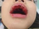 저희 딸 치고 도망간 뺑소니범 좀 찾아주세요.ㅜㅜ