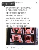 [스레드] 원래 치과가면 이렇게 찍어?