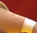 아시안게임 유도, 상대선수 팔 물어 반칙패 당한 중국선수