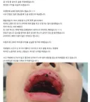 보배발 어린이 뺑소니범 검거 뒤 충격적인 반전 ㄷㄷ