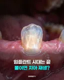 또 사고친 국내 연구진 소식