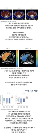 마운자로 1년 맞고 내장지방에 생긴 변화