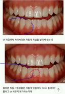 치실 해도 나는 음식물이나 그런거 하나도 안나와..