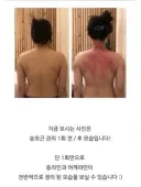 승모근 교정 후기