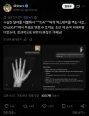 비싼돈을 들이지 않고 엑스레이를 찍는 방법.twit