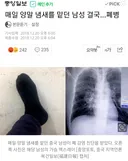 매일 양말 냄새를 맡던 남성 폐병.jpg
