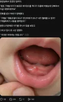 잇몸에 사탕이 박혀 응급실 온 7개월 아기