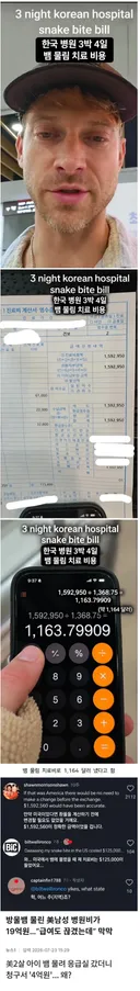 미국인의 한국병원 3박4일 뱀물림 치료 비용