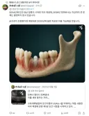 탈모약만은 절대 개발이 안될 듯...