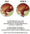 인체에서 가장 중요한 근육