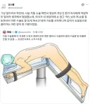 치질 수술 썰.jpg