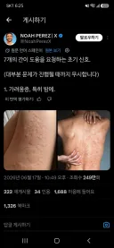 간이 도움을 요청하는 7개의 신호